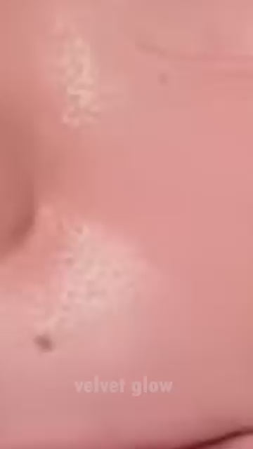Glow Skin Derma Roller